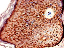 Immunohistochemistry of paraffin-embedded human skin tissue using CSB-PA724336LA01HU at dilution of 1:100