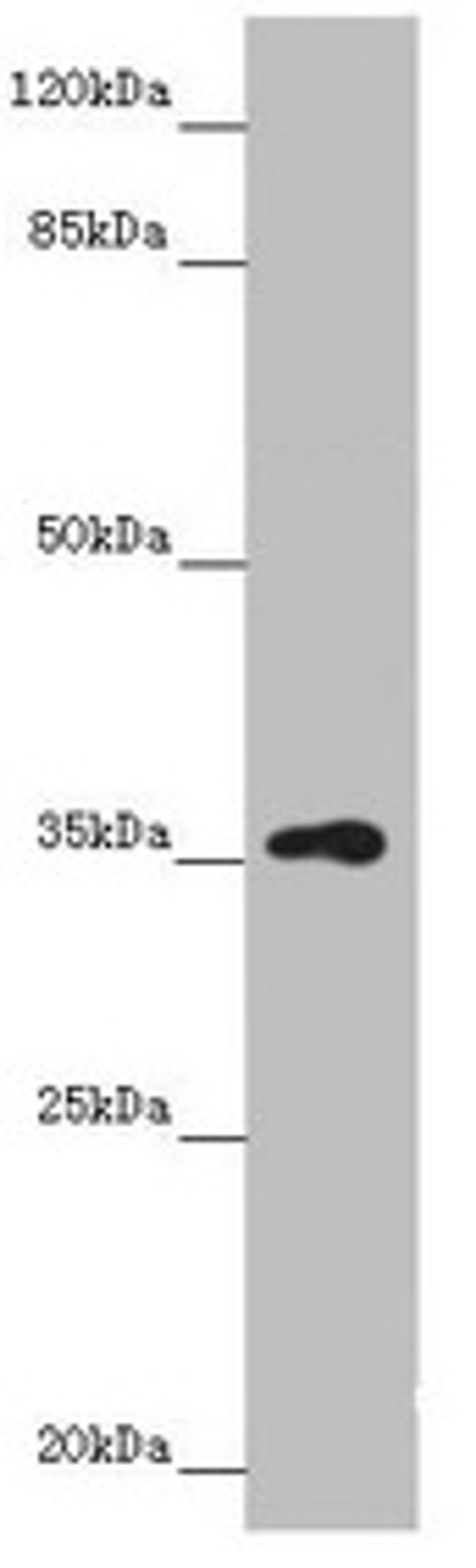 Western blot. All lanes: GNB1L antibody at 3.37µg/ml + A549 whole cell lysate. Secondary. Goat polyclonal to rabbit IgG at 1/10000 dilution. Predicted band size: 36, 23 kDa. Observed band size: 36 kDa