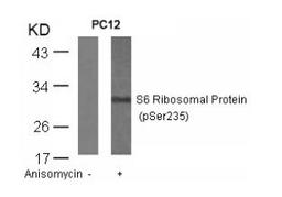 Western blot analysis of lysed extracts from PC12 cells untreated or treated with anisomycin using S6 Ribosomal Protein (Phospho-Ser235).