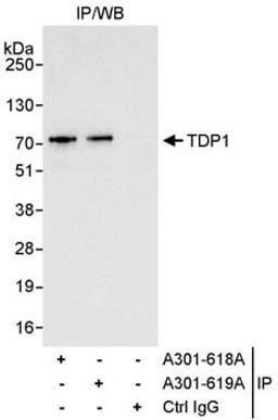 Detection of human TDP1 by western blot of immunoprecipitates.