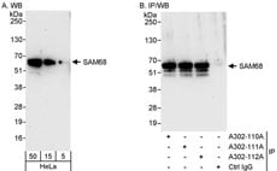 Detection of human SAM68 by western blot and immunoprecipitation.