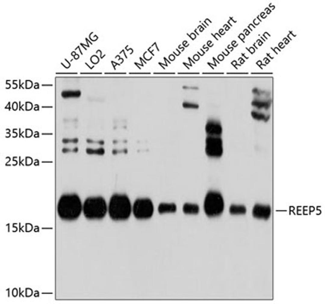 Western blot - REEP5 antibody (A10392)