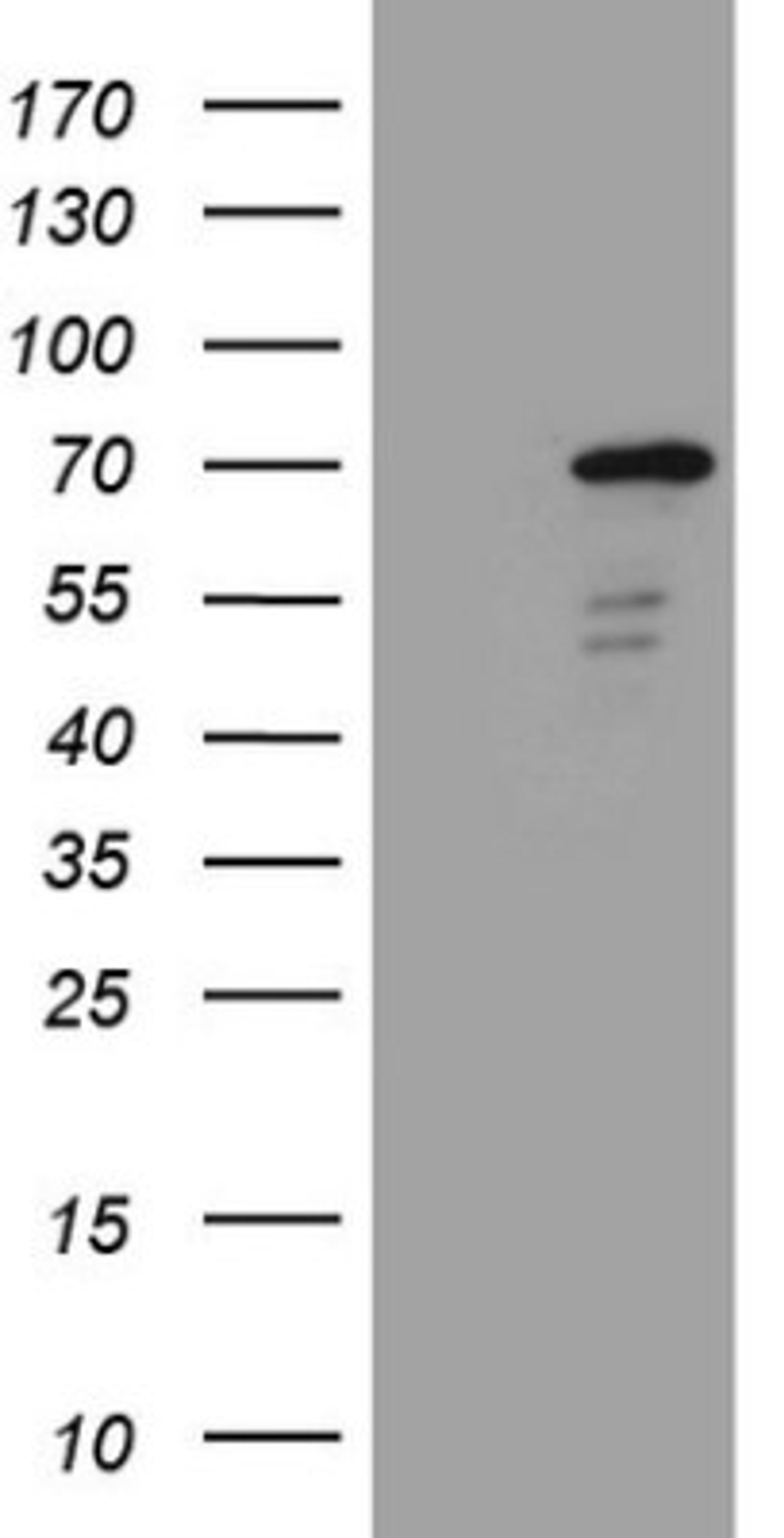 Western Blot: ZNF449 Antibody (4C6) [NBP2-46453] - Analysis of HEK293T cells were transfected with the pCMV6-ENTRY control (Left lane) or pCMV6-ENTRY ZNF449.