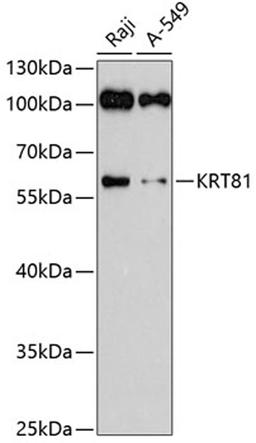 Western blot - KRT81 antibody (A3940)