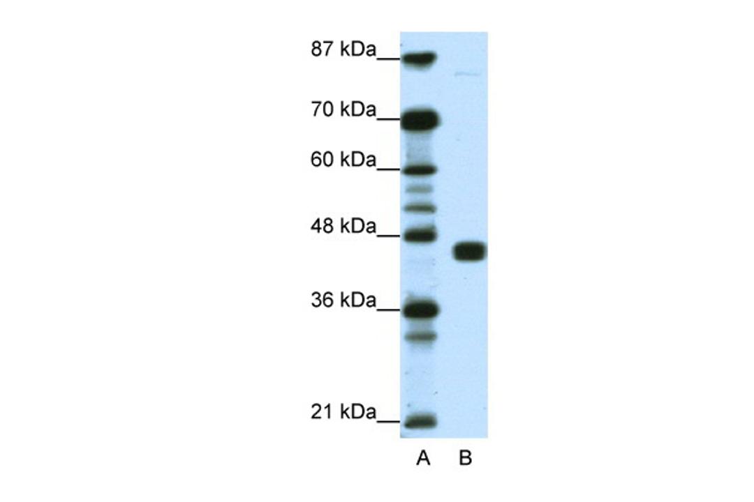 Antibody used in WB on Human Jurkat 1.25 ug/ml.