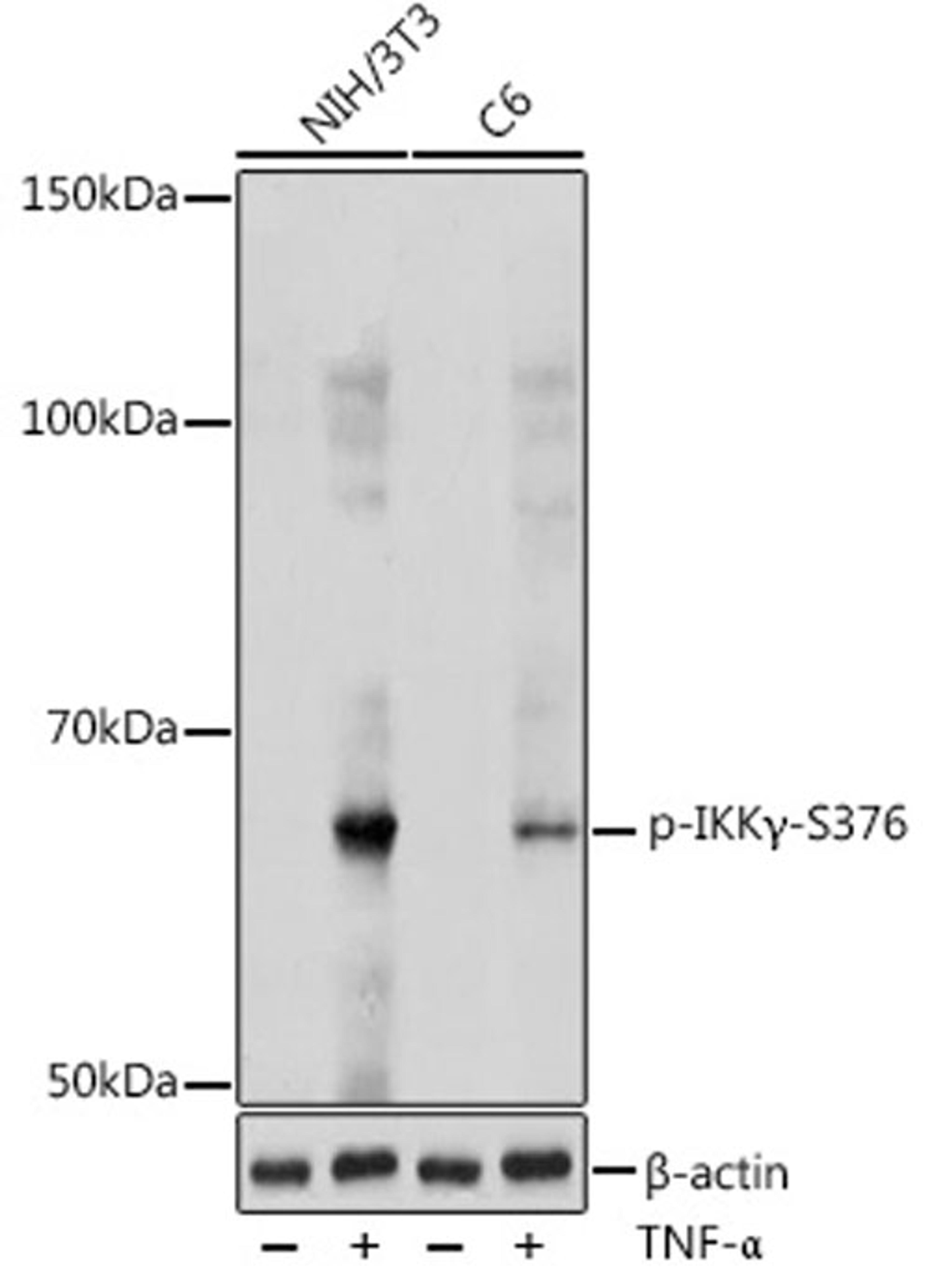 Western blot - Phospho-IKK?-S376 antibody (AP1111)