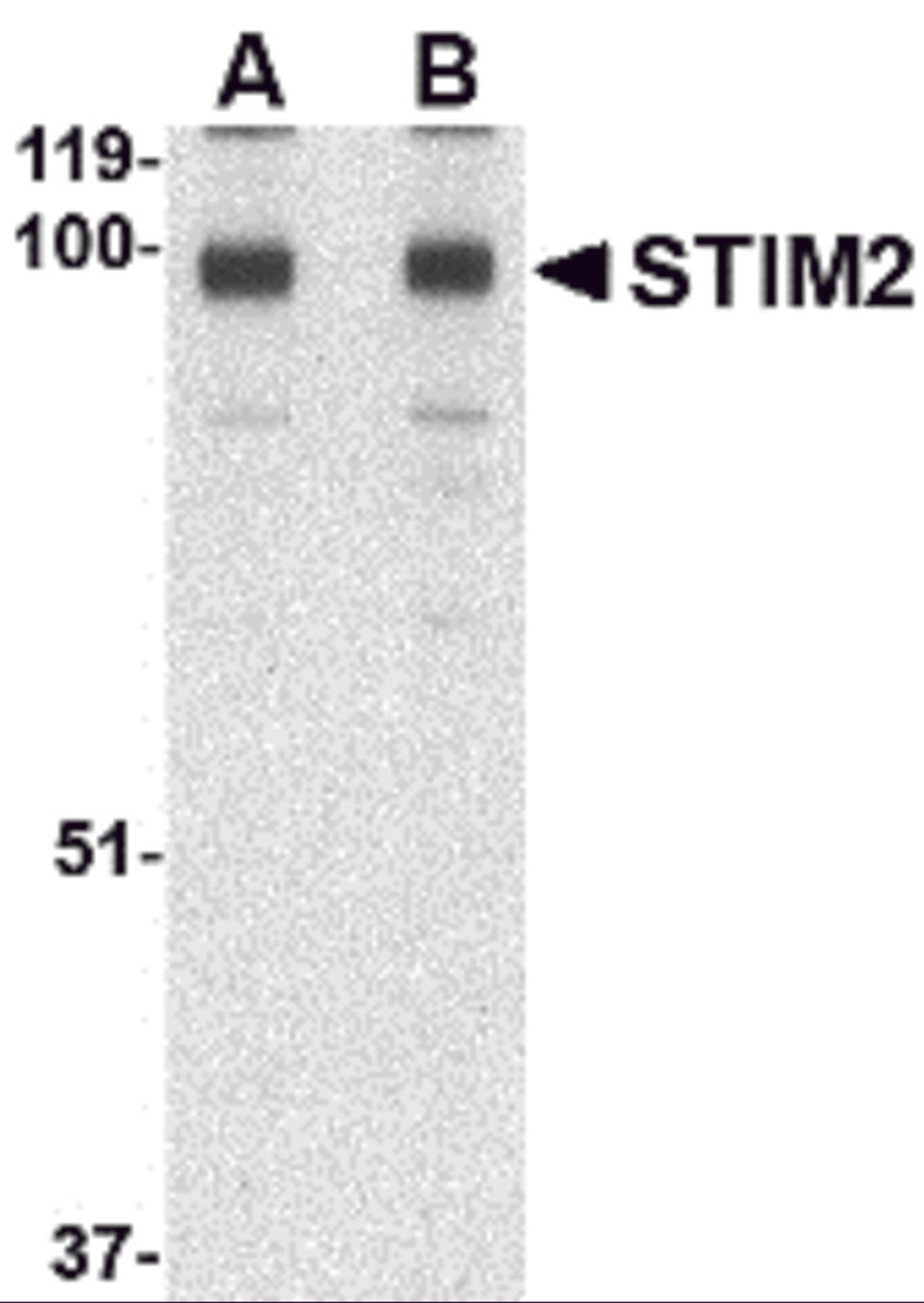 Western blot analysis of STIM2 in A-20 cell lysate with STIM2 antibody at (A) 0.5 and (B) 1 &#956;g/mL.