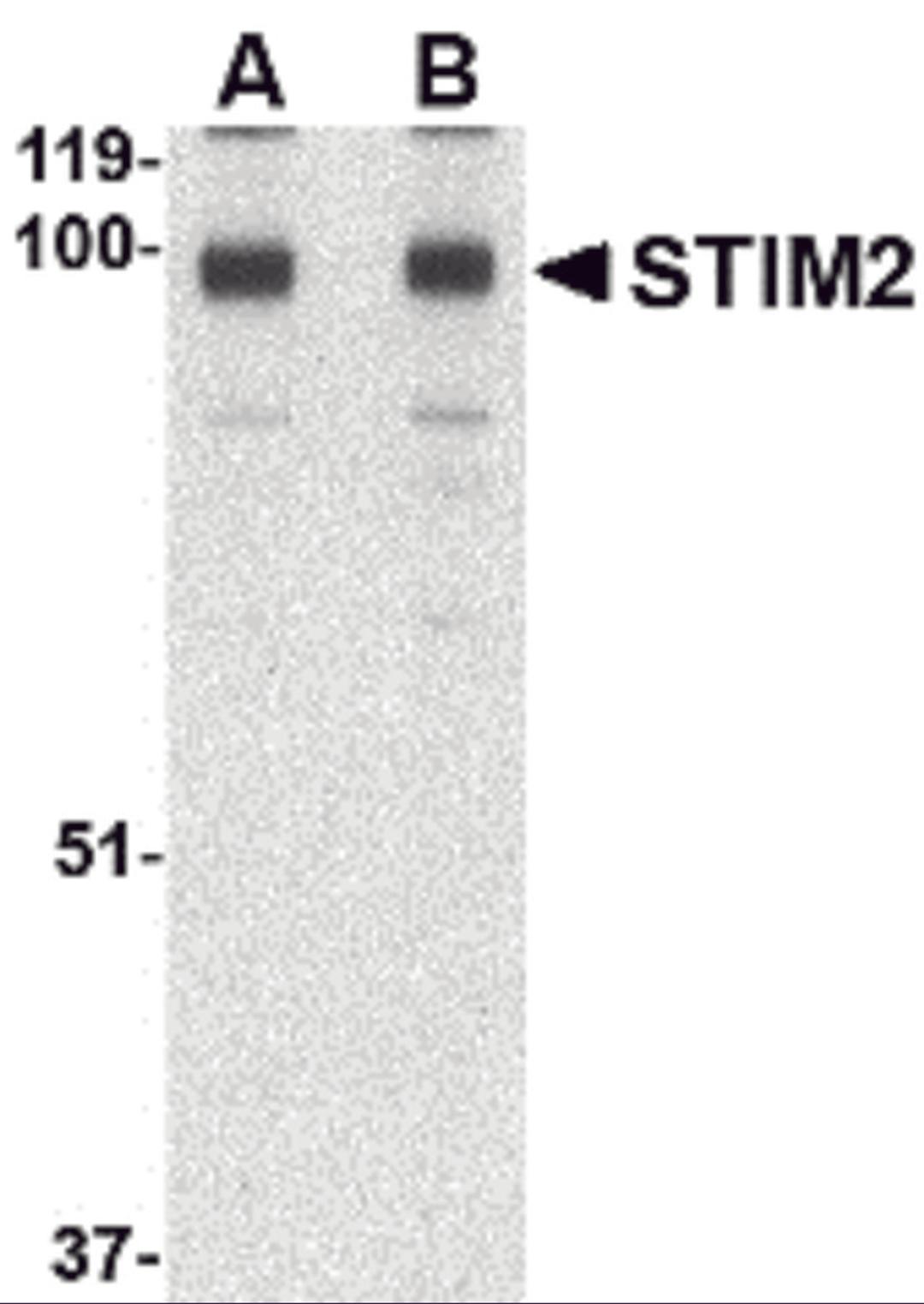 Western blot analysis of STIM2 in A-20 cell lysate with STIM2 antibody at (A) 0.5 and (B) 1 μg/mL.