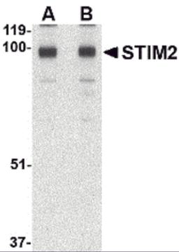 Western blot analysis of STIM2 in A-20 cell lysate with STIM2 antibody at (A) 0.5 and (B) 1 μg/mL.
