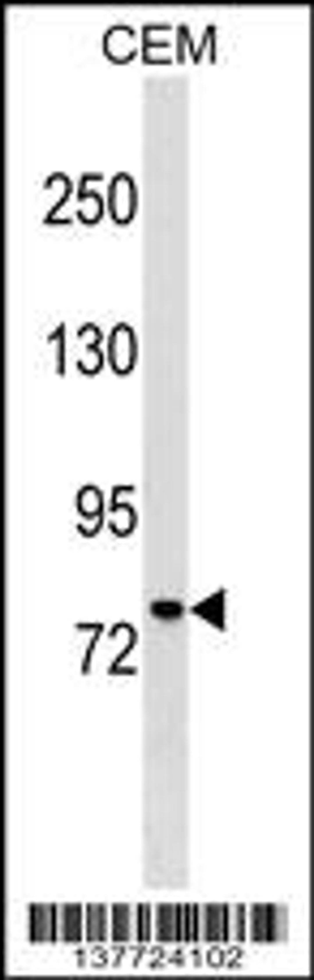 Western blot analysis in CEM cell line lysates (35ug/lane).