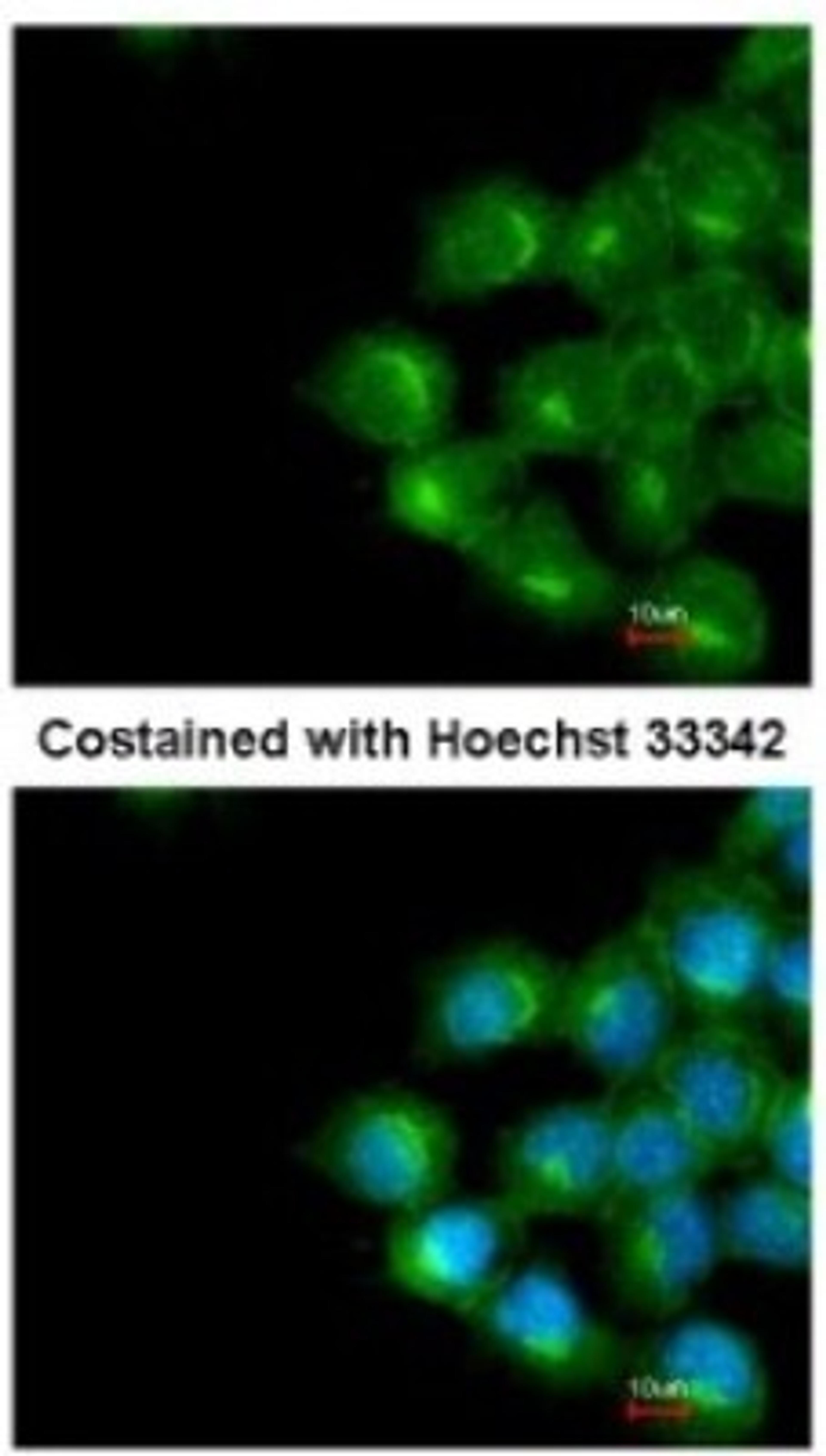 Immunocytochemistry/Immunofluorescence: Scramblase 1 Antibody [NBP1-32588] - Analysis of methanol-fixed A431, using antibody at 1:200 dilution.