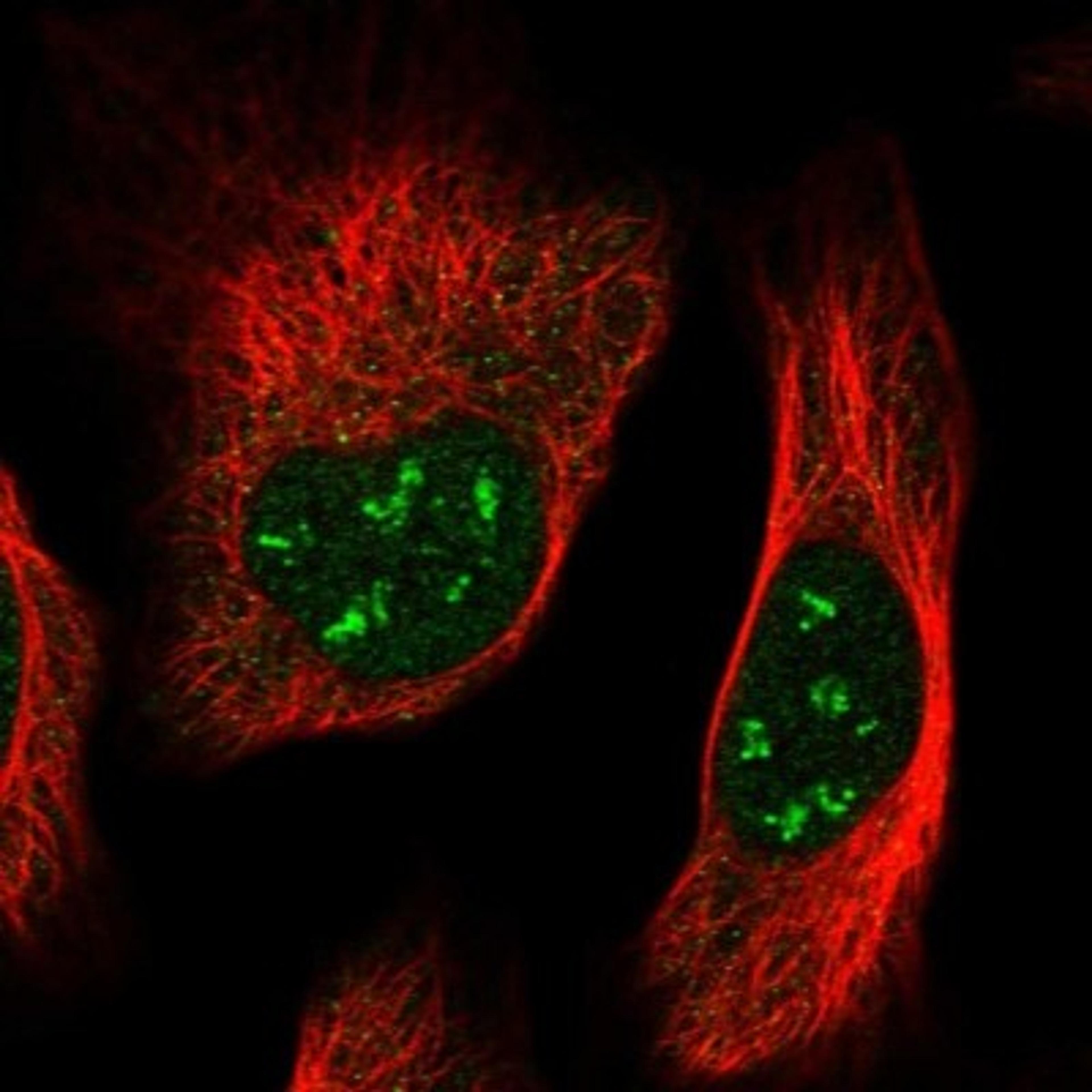 Immunocytochemistry/Immunofluorescence: RPUSD3 Antibody [NBP1-81135] - Staining of human cell line U-2 OS shows positivity in nucleoli.