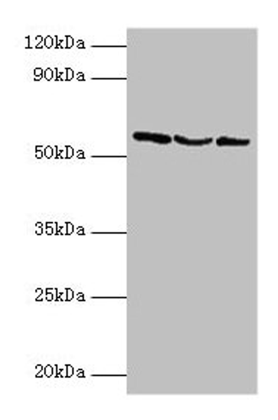 Western blot. All lanes: USP14 antibody at 2µg/ml. Lane 1: Hela whole cell lysate. Lane 2: 293T whole cell lysate. Lane 3: NIH/3T3 whole cell lysate. Secondary. Goat polyclonal to rabbit IgG at 1/10000 dilution. Predicted band size: 57, 53, 55 kDa. Observed band size: 57 kDa