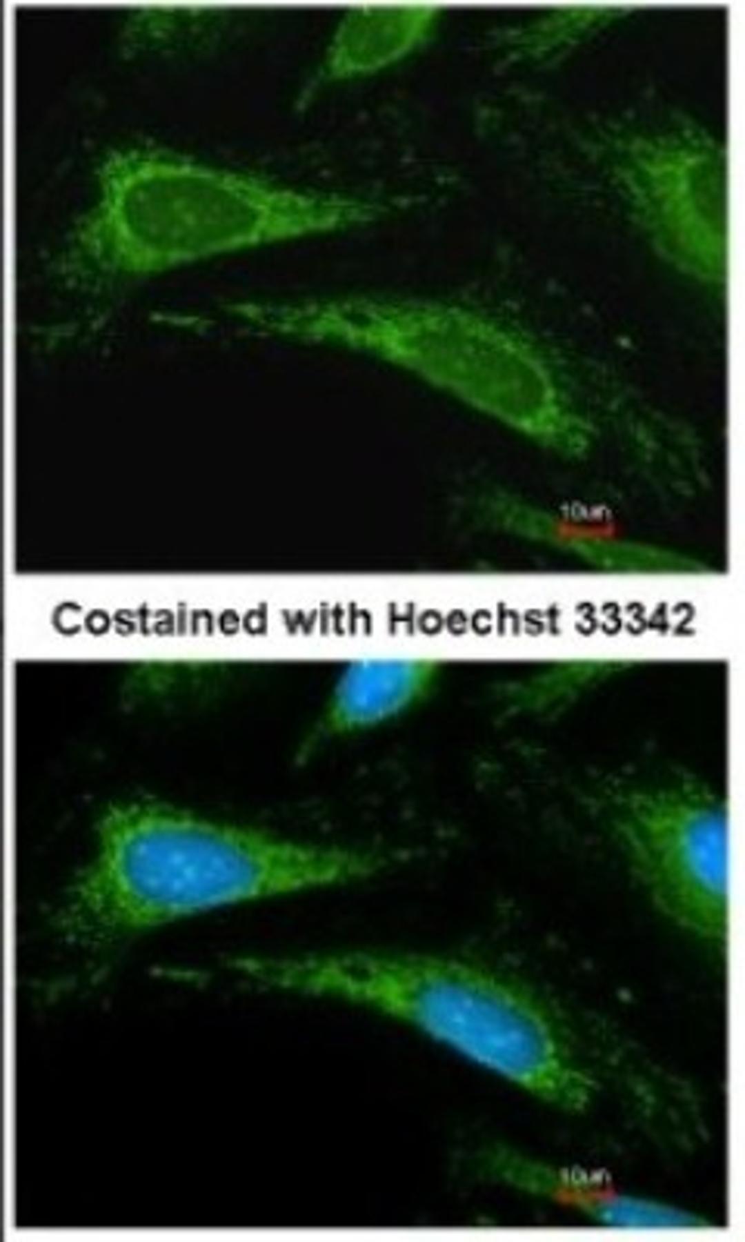 Immunocytochemistry/Immunofluorescence: Cyclophilin A Antibody [NBP1-30993] - Methanol-fixed HeLa, using Cyclophilin A antibody at 1:200 dilution.