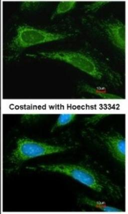 Immunocytochemistry/Immunofluorescence: Cyclophilin A Antibody [NBP1-30993] - Methanol-fixed HeLa, using Cyclophilin A antibody at 1:200 dilution.