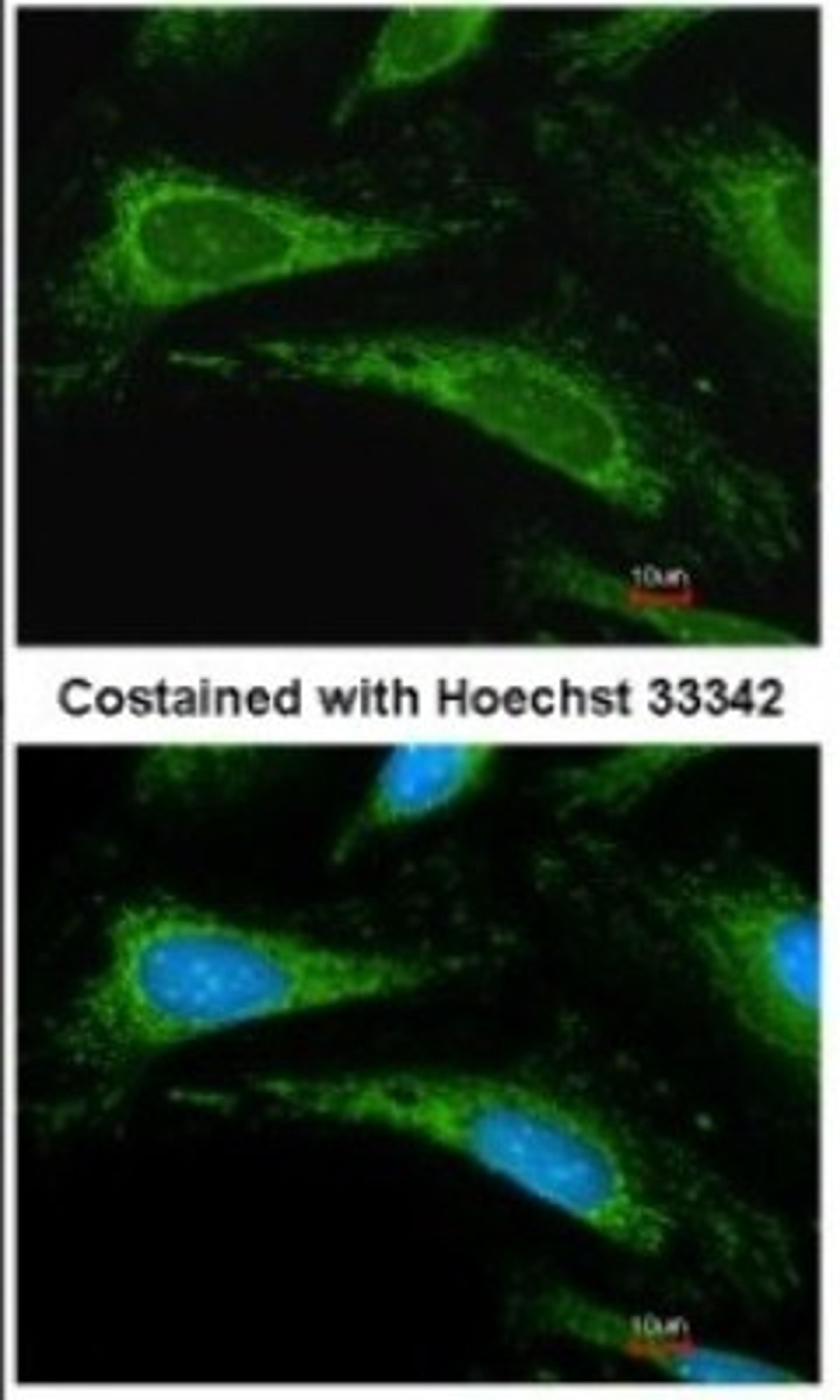 Immunocytochemistry/Immunofluorescence: Cyclophilin A Antibody [NBP1-30993] - Methanol-fixed HeLa, using Cyclophilin A antibody at 1:200 dilution.