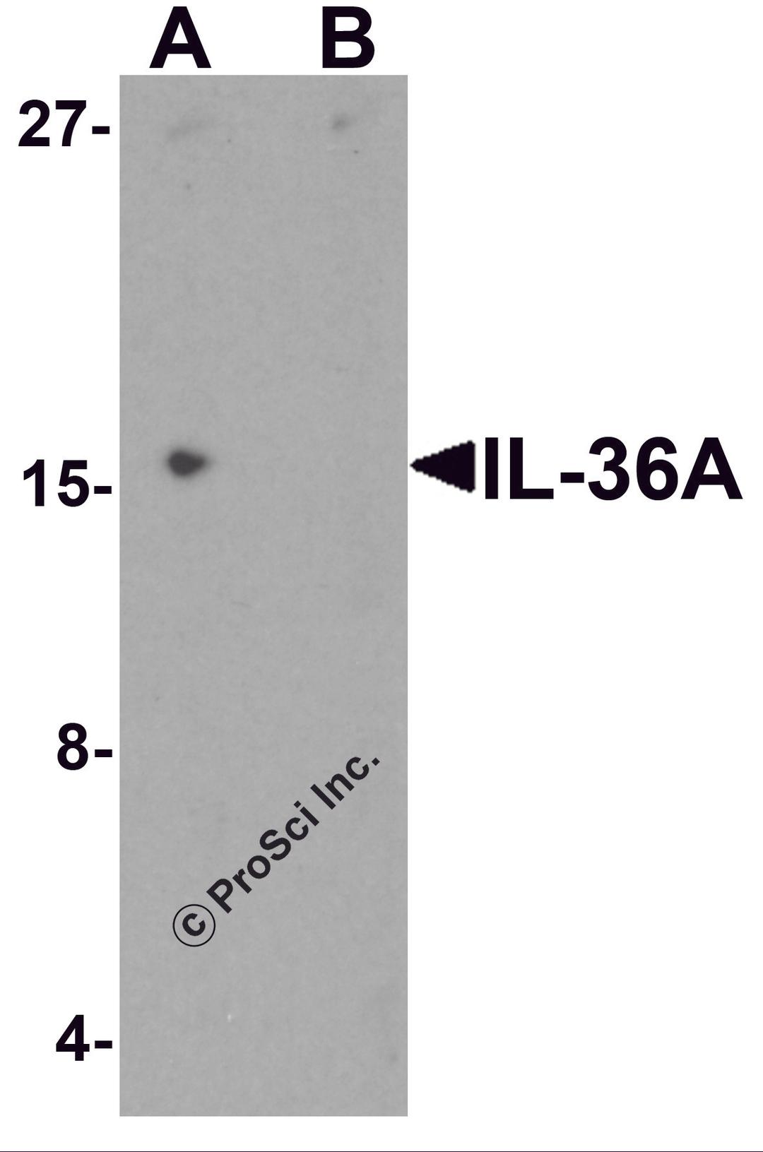 Western blot analysis of IL-36A in MCF7 cell lysate with IL-36A antibody at 1 μg/ml in (A) the absence and (B) the presence of blocking peptide.
