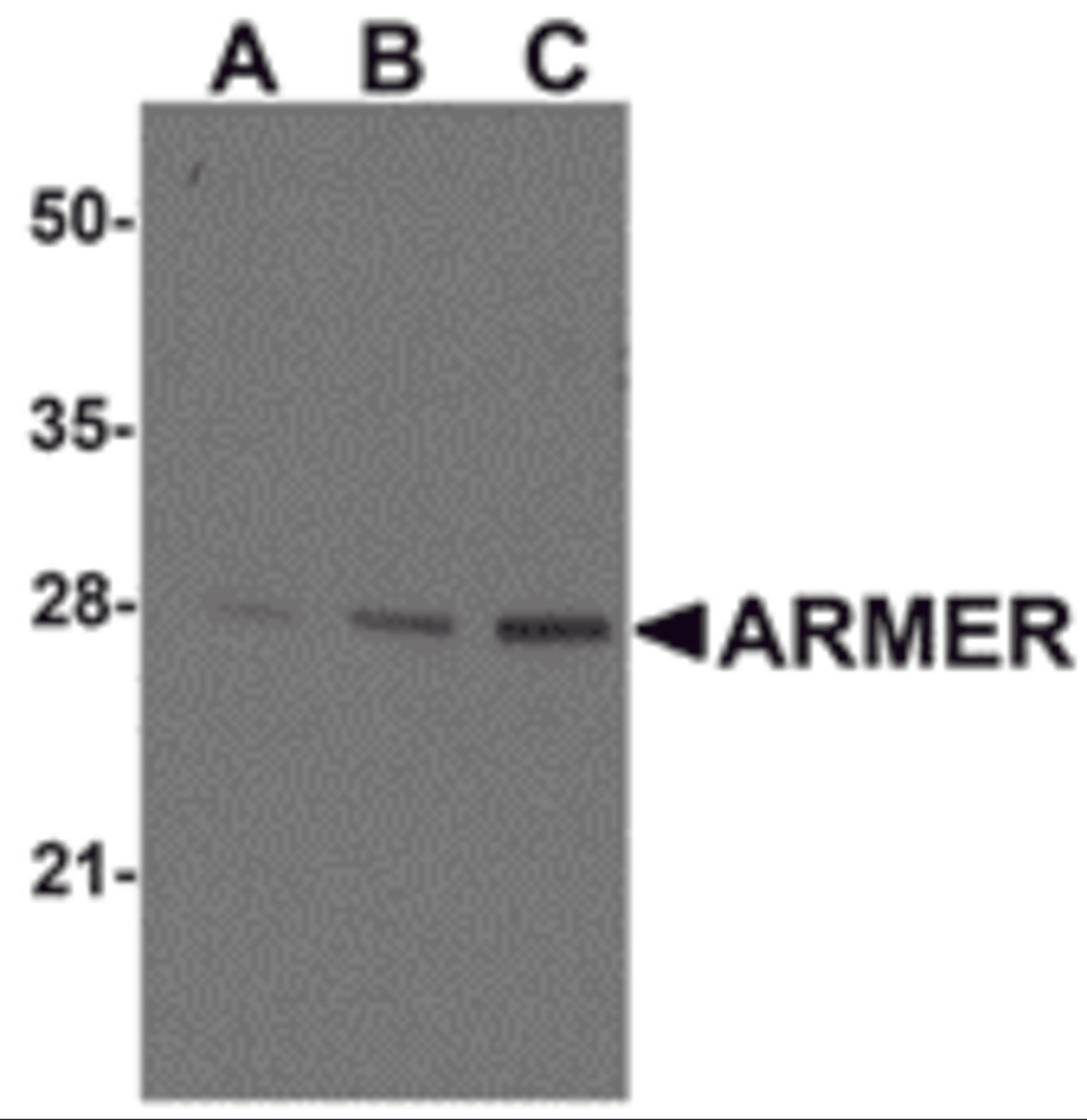 Western blot ana-lysis of ARMER in mouse small intestine tissue lysates with ARMER antibody at (A) 0.5, (B) 1, and (C) 2 &#956;g/mL. 