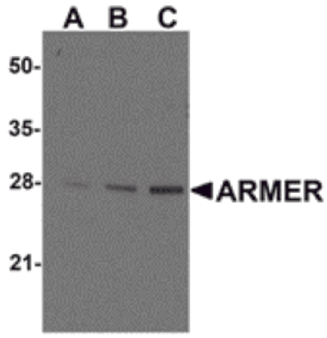 Western blot ana-lysis of ARMER in mouse small intestine tissue lysates with ARMER antibody at (A) 0.5, (B) 1, and (C) 2 μg/mL.