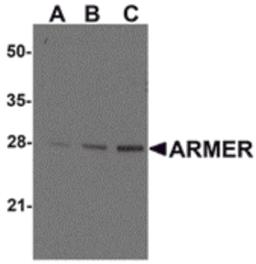 Western blot ana-lysis of ARMER in mouse small intestine tissue lysates with ARMER antibody at (A) 0.5, (B) 1, and (C) 2 μg/mL.