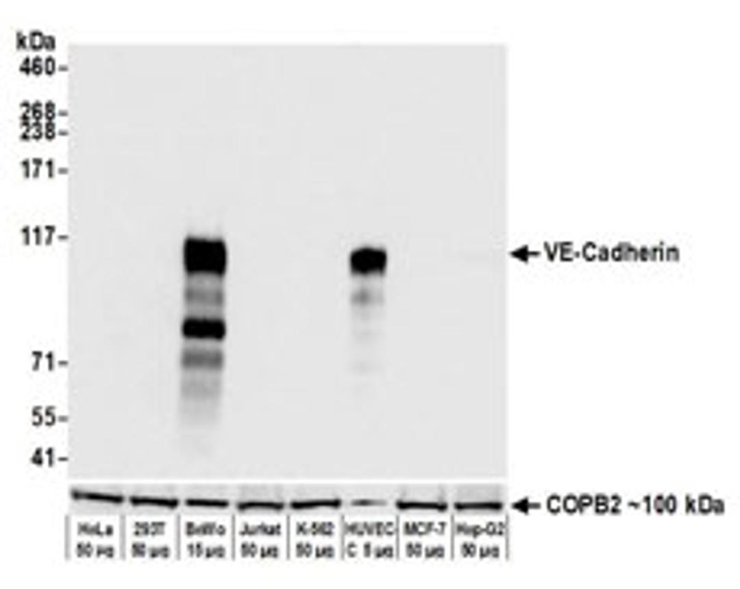 Detection of human VE-Cadherin by western blot.