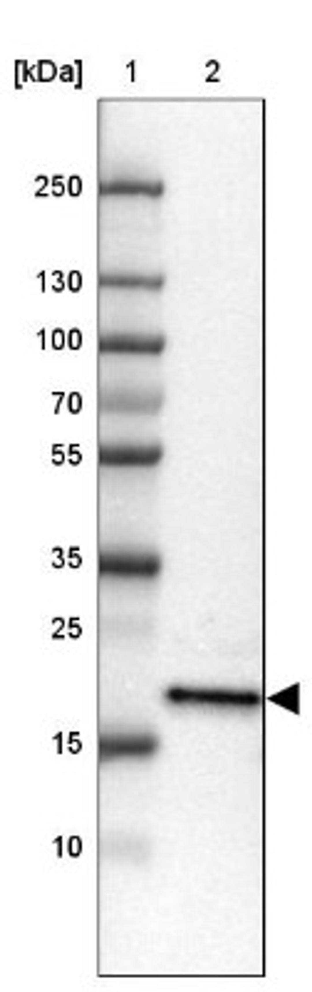 Western Blot: ZNF22 Antibody [NBP1-81739] - Lane 1: Marker [kDa] 250, 130, 100, 70, 55, 35, 25, 15, 10<br/>Lane 2: Tonsil