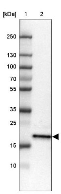 Western Blot: ZNF22 Antibody [NBP1-81739] - Lane 1: Marker [kDa] 250, 130, 100, 70, 55, 35, 25, 15, 10<br/>Lane 2: Tonsil