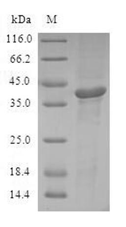 (Tris-Glycine gel) Discontinuous SDS-PAGE (reduced) with 5% enrichment gel and 15% separation gel.