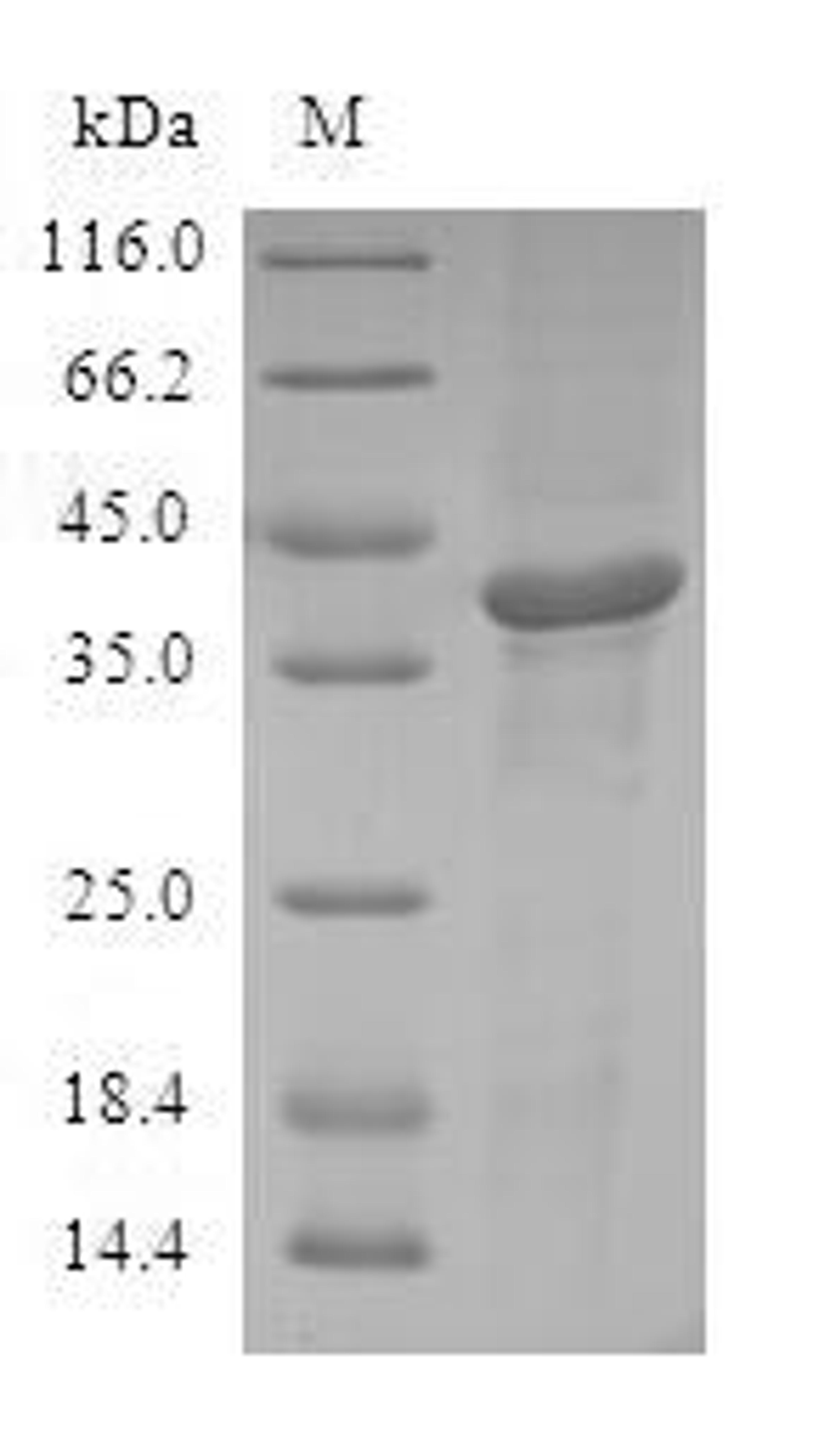 (Tris-Glycine gel) Discontinuous SDS-PAGE (reduced) with 5% enrichment gel and 15% separation gel.