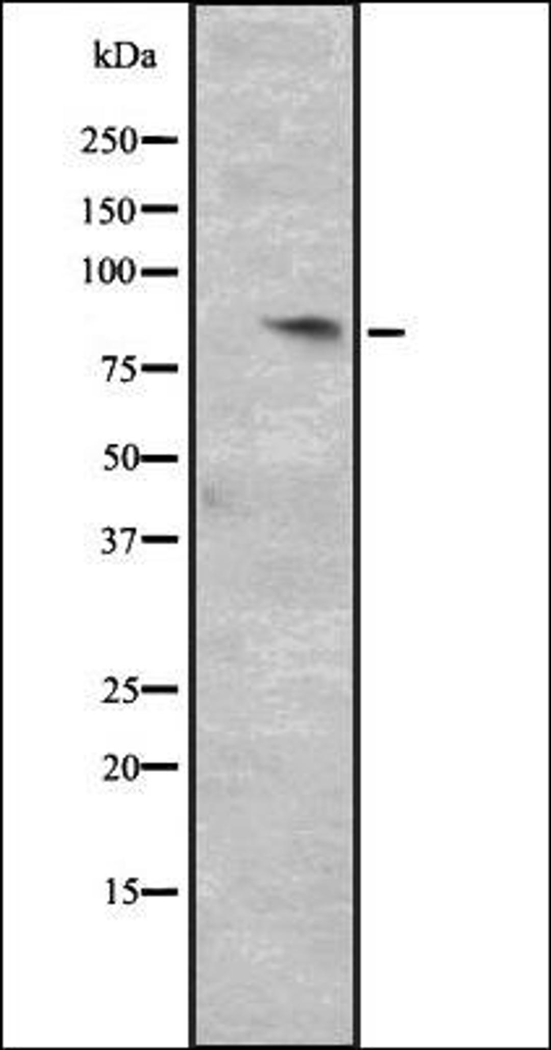 Western blot analysis of HepG2 whole cell lysate using CCNT2 antibody