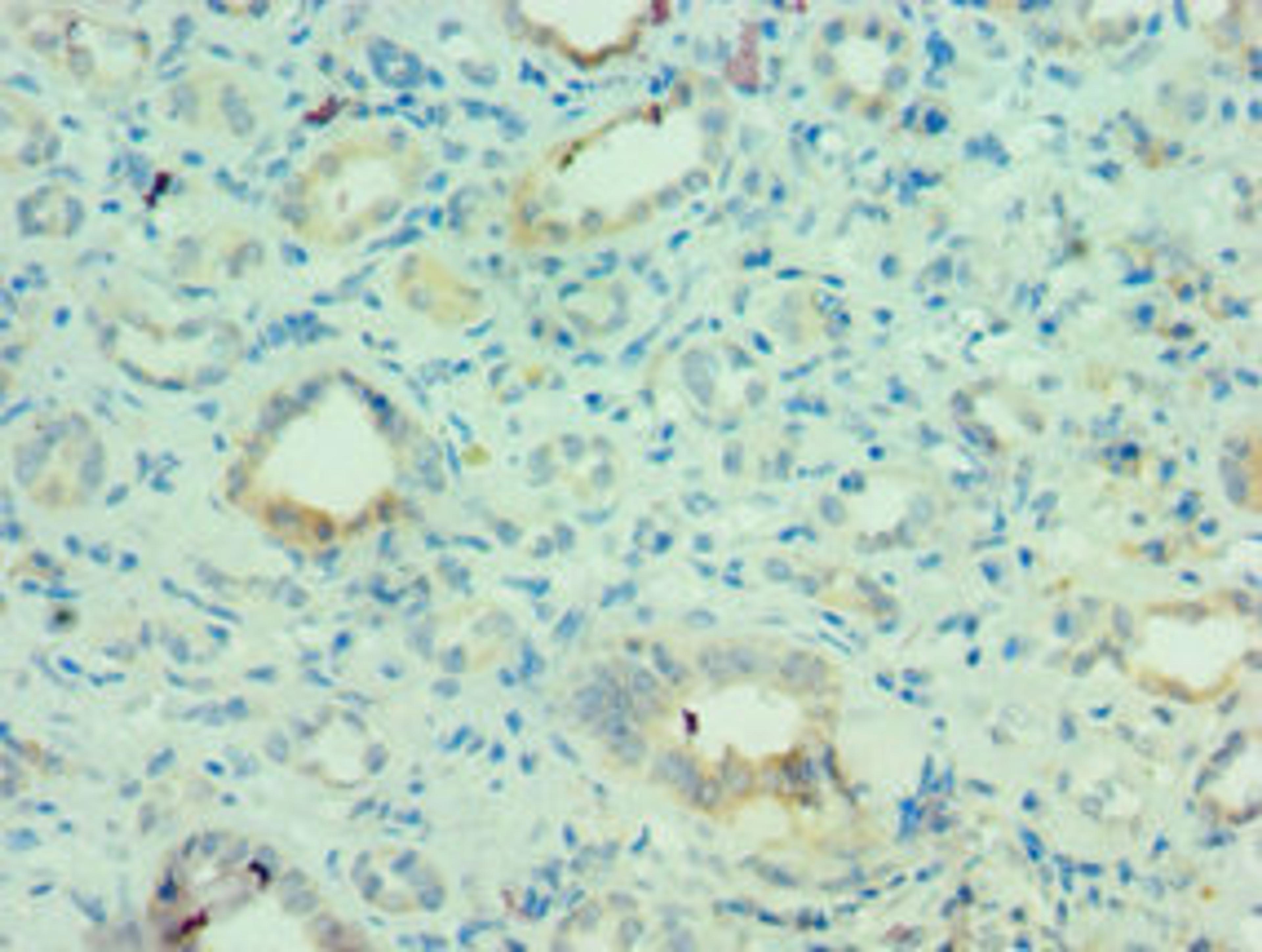 Immunohistochemistry of paraffin-embedded human kidney tissue using CSB-PA621968ESR1HU at dilution of 1:100