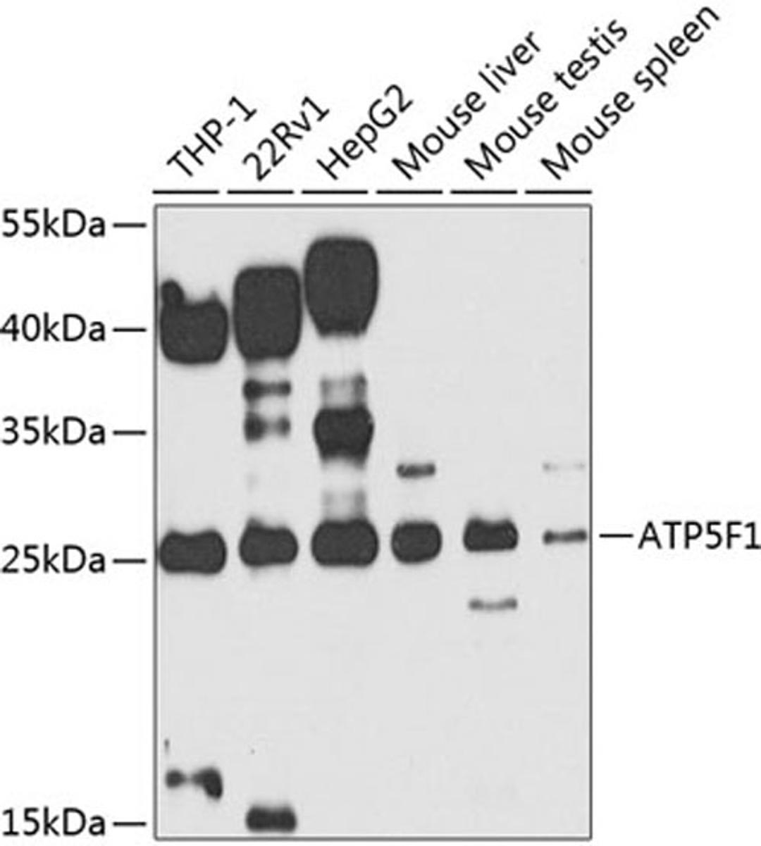 Western blot - ATP5F1 antibody (A7645)