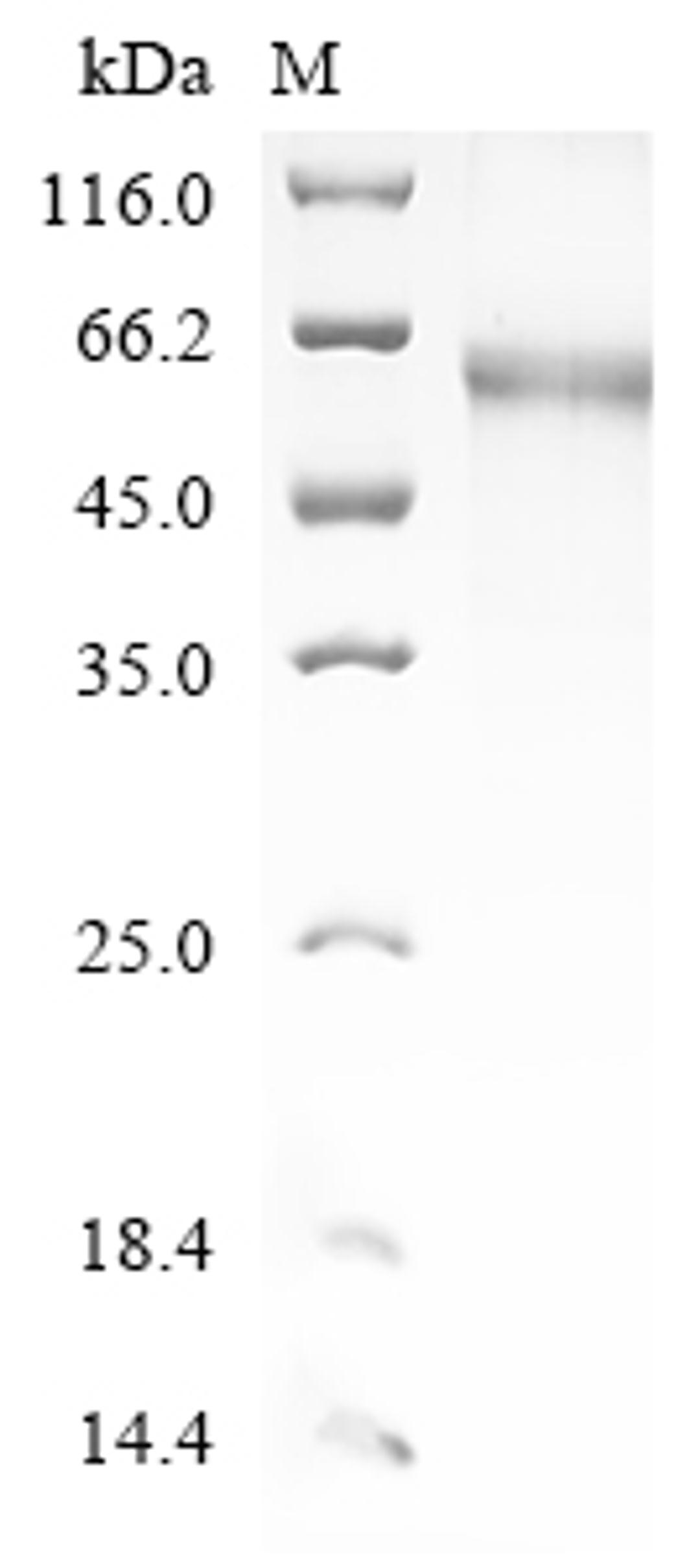 (Tris-Glycine gel) Discontinuous SDS-PAGE (reduced) with 5% enrichment gel and 15% separation gel.