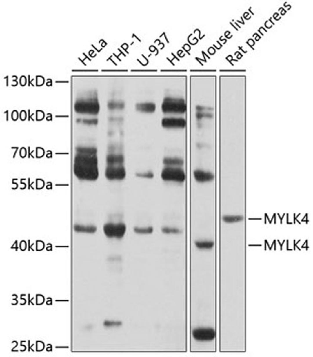 Western blot - MYLK4 antibody (A10000)