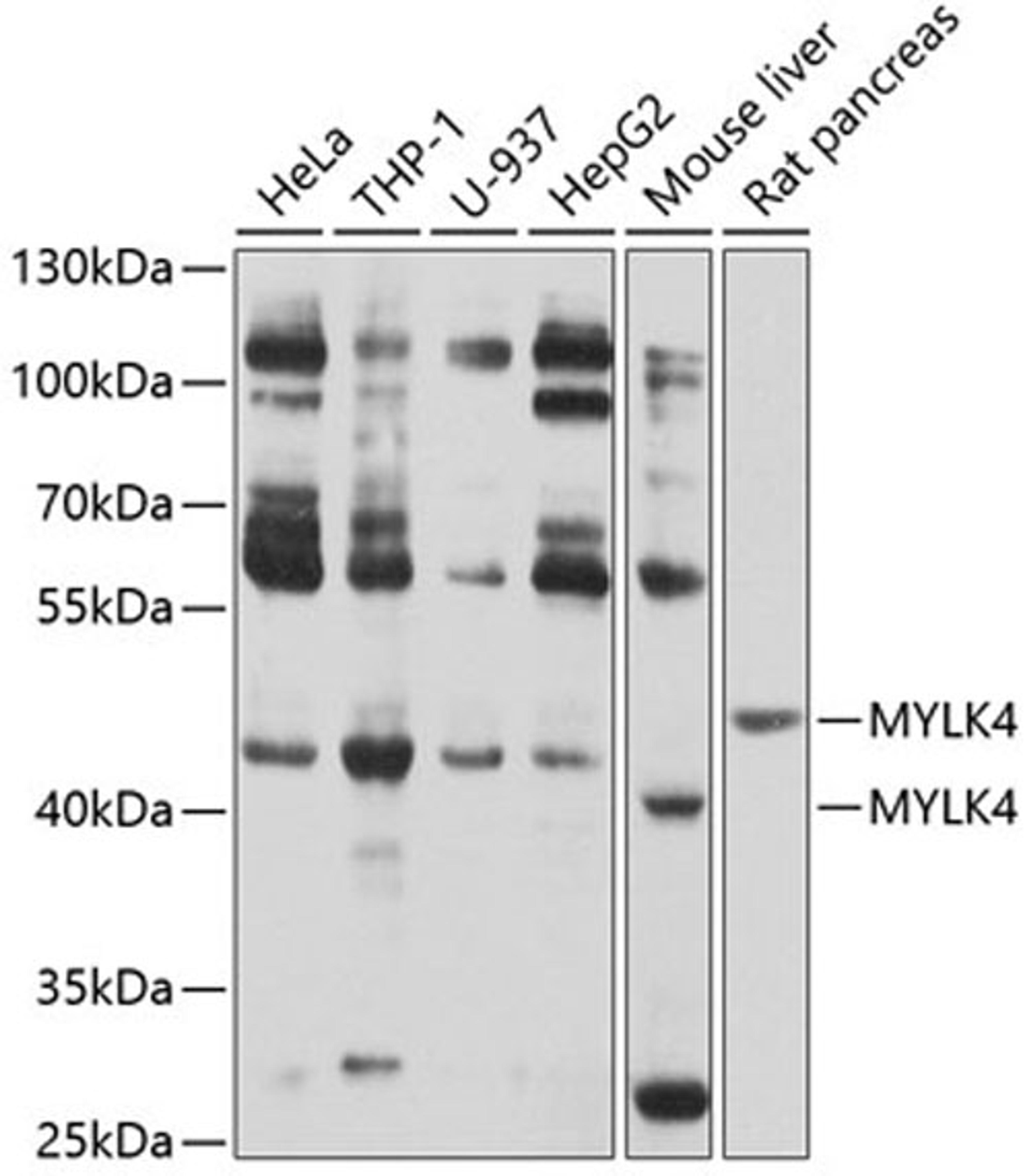 Western blot - MYLK4 antibody (A10000)