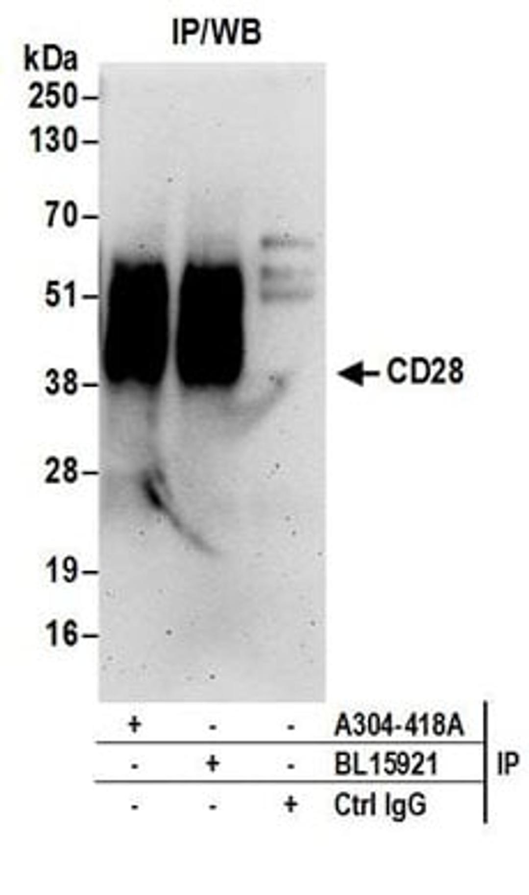 Detection of human CD28 by western blot of immunoprecipitates.