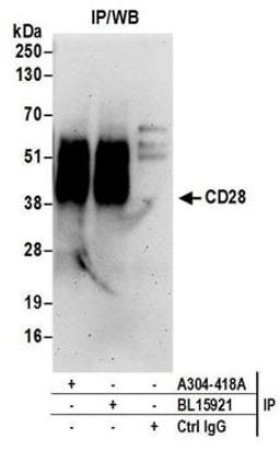 Detection of human CD28 by western blot of immunoprecipitates.