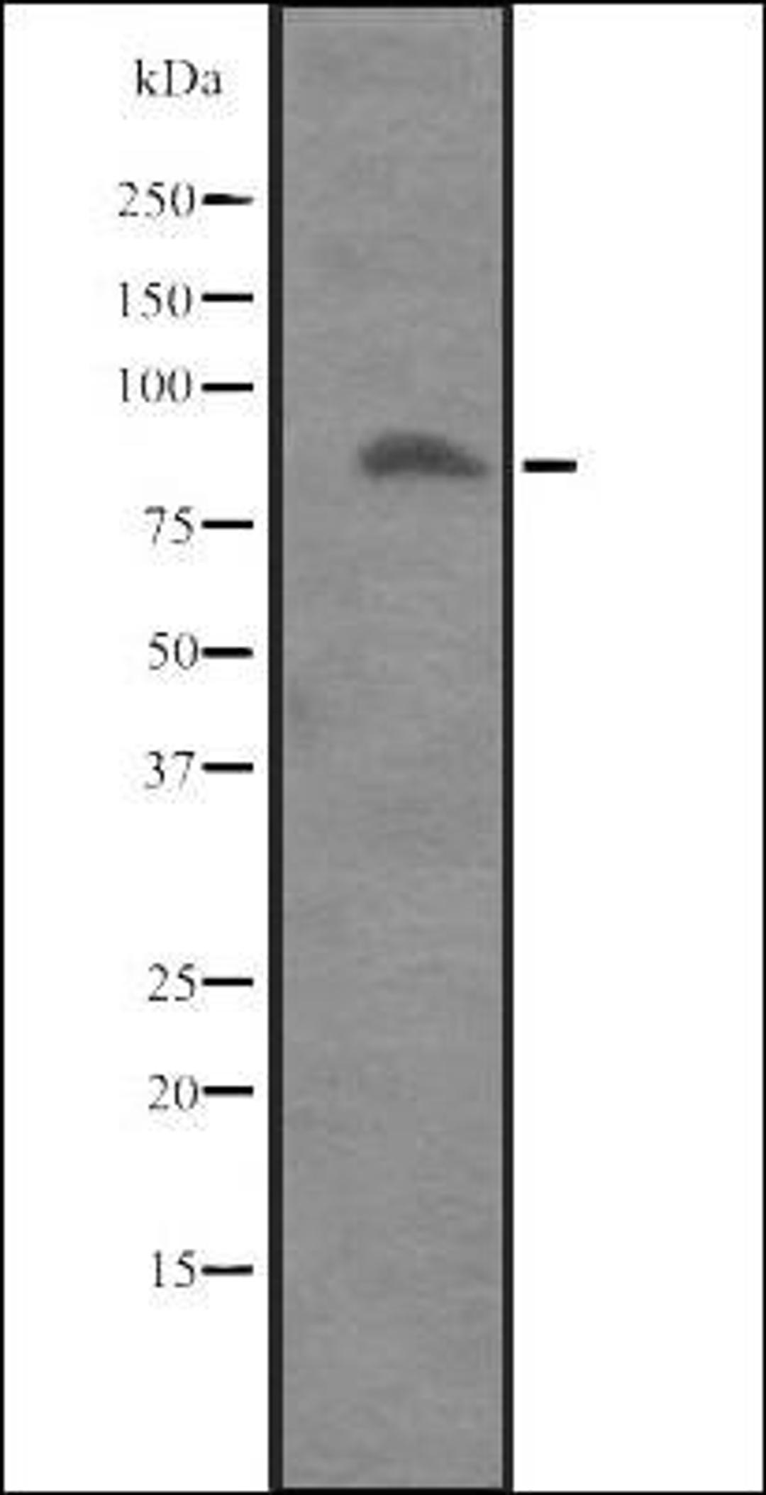 Western blot analysis of Placenta lysate using ITGB8 antibody