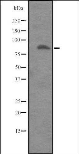 Western blot analysis of Placenta lysate using ITGB8 antibody