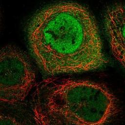 Immunocytochemistry/Immunofluorescence: CENPV Antibody [NBP1-84545] - Staining of human cell line A-431 shows positivity in nucleus but not nucleoli & cytoplasm.