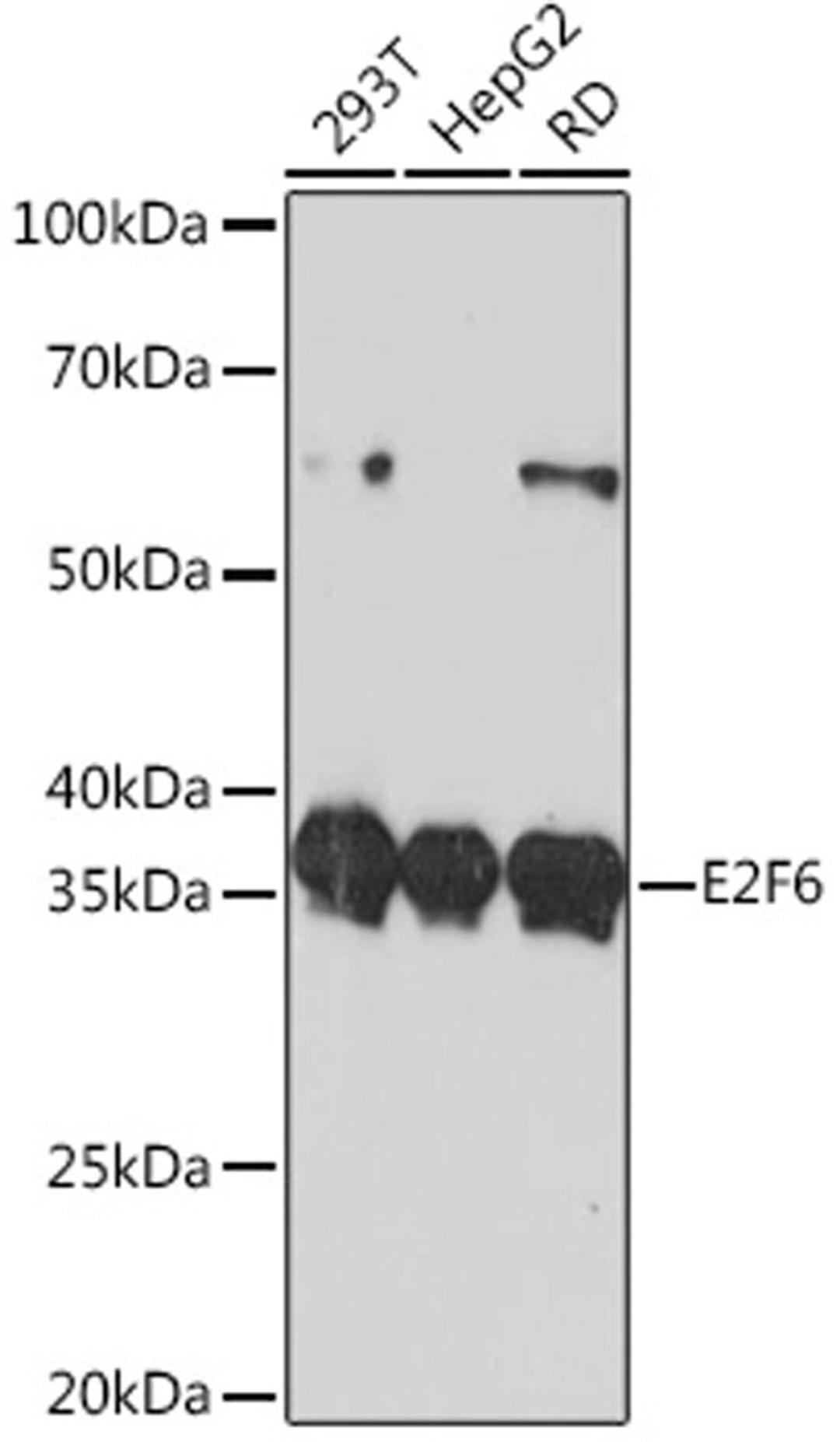 Western blot - E2F6 Rabbit mAb (A11546)