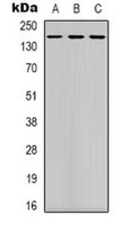 Western blot analysis of K562 (Lane 1), mouse brain (Lane 2), NIH3T3 (Lane 3) whole cell lysates using DAP Kinase 1 antibody