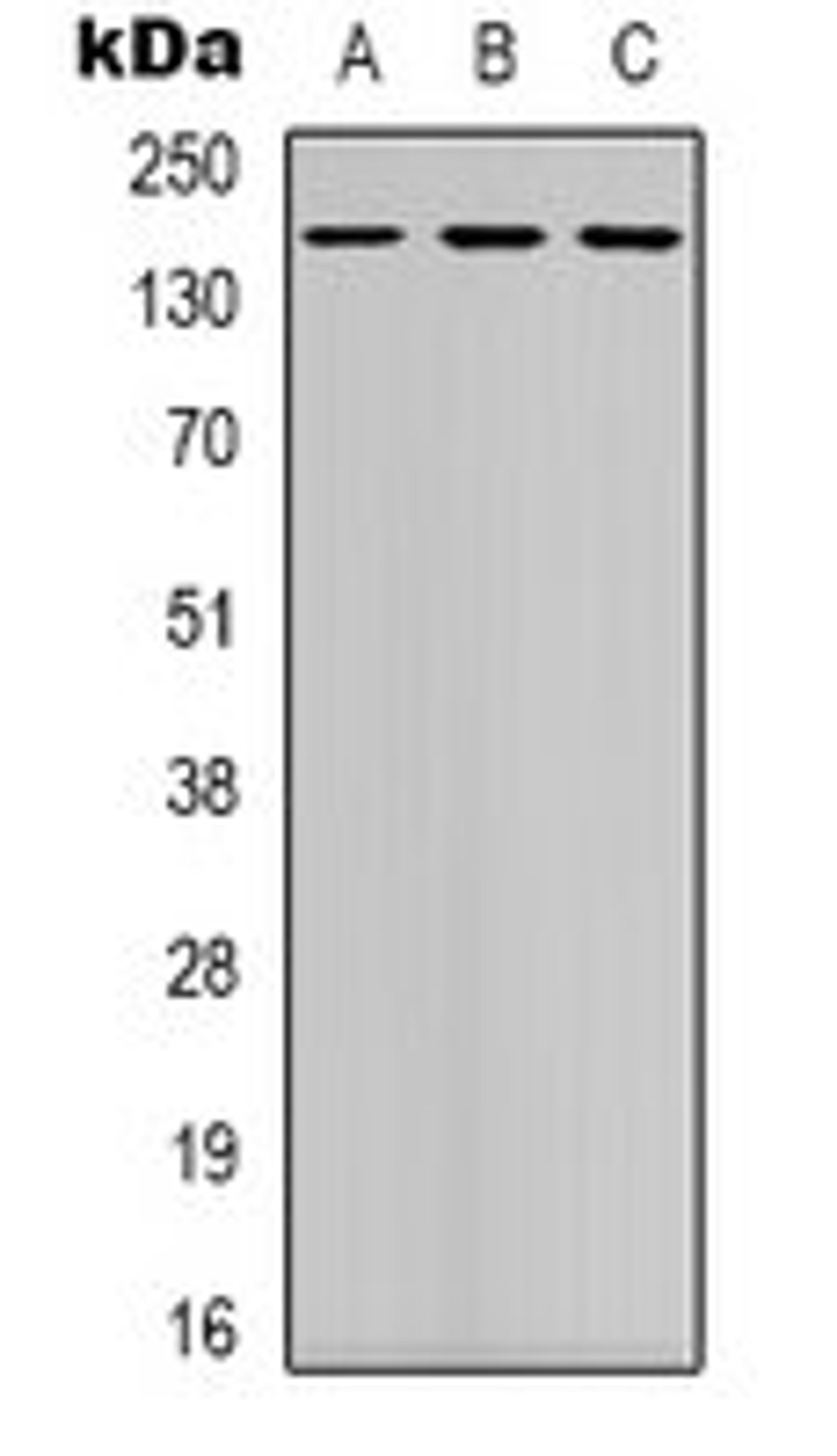 Western blot analysis of K562 (Lane 1), mouse brain (Lane 2), NIH3T3 (Lane 3) whole cell lysates using DAP Kinase 1 antibody