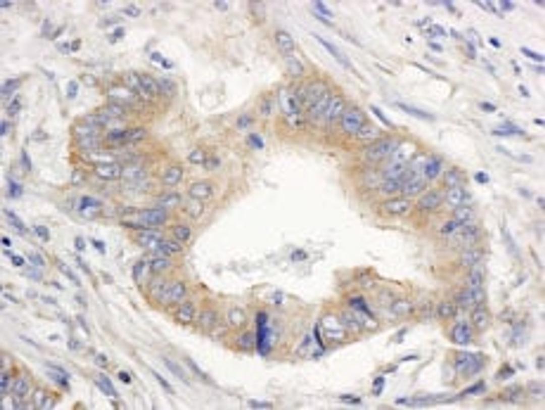 Detection of human SPTAN1/Alpha II-Spectrin by immunohistochemistry.