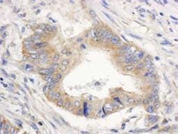 Detection of human SPTAN1/Alpha II-Spectrin by immunohistochemistry.