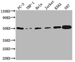 Western Blot. Positive WB detected in: PC-3 whole cell lysate, THP-1 whole cell lysate, Hela whole cell lysate, Jurkat whole cell lysate, K562 whole cell lysate, U87 whole cell lysate. All lanes: PTPN1 antibody at 1:2000. Secondary. Goat polyclonal to rabbit IgG at 1/50000 dilution. Predicted band size: 50 kDa. Observed band size: 50 kDa. 
