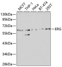 Western blot - ERG antibody (A1240)