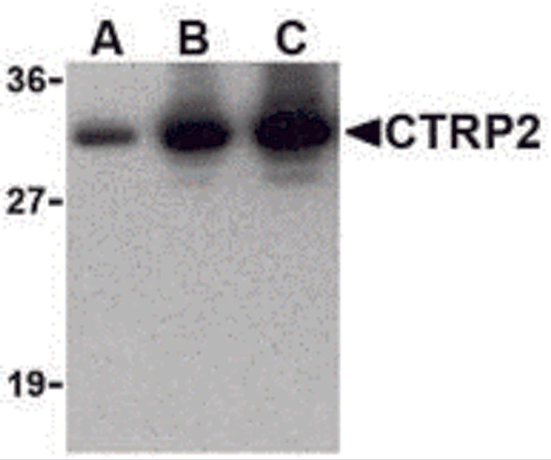 Western blot of recombinant CTRP2: (A) 5 ng, (B) 25 ng, and (C) 50 ng with CTRP2 at 1 &#956;g/mL.