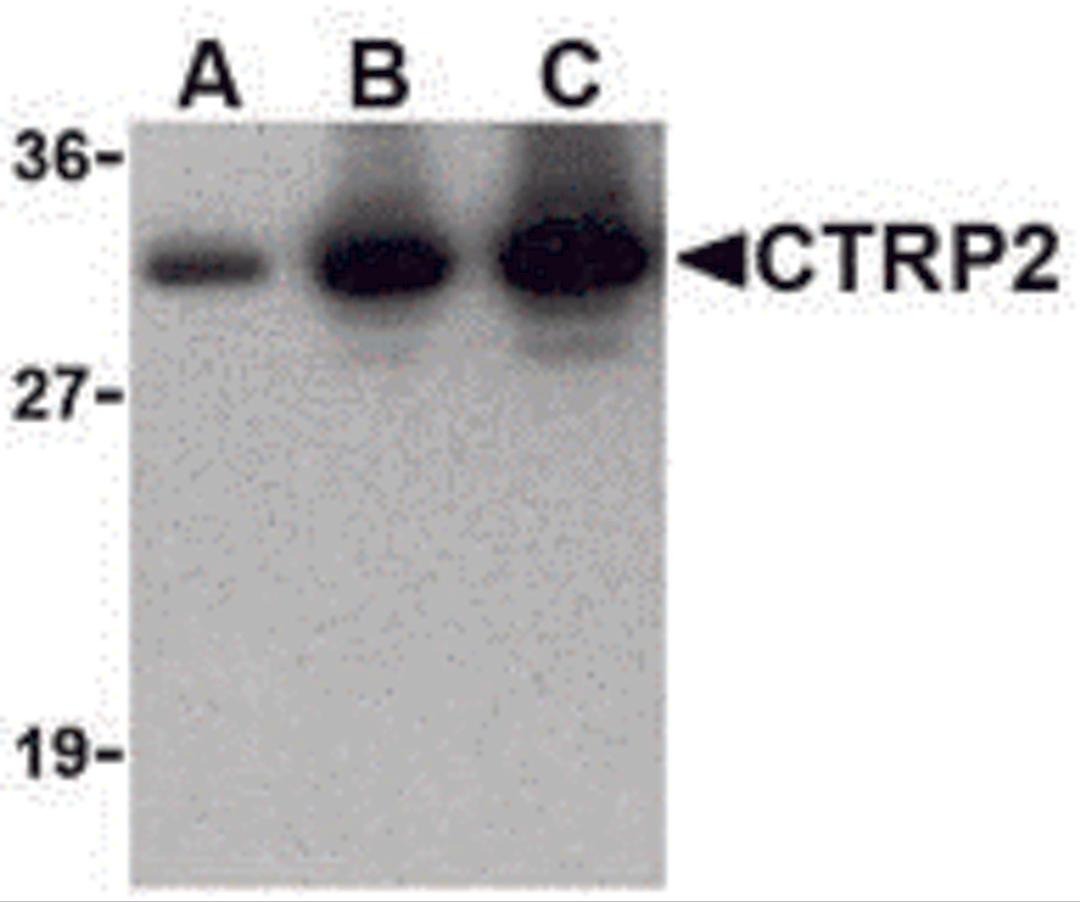 Western blot of recombinant CTRP2: (A) 5 ng, (B) 25 ng, and (C) 50 ng with CTRP2 at 1 μg/mL.