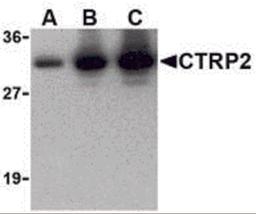 Western blot of recombinant CTRP2: (A) 5 ng, (B) 25 ng, and (C) 50 ng with CTRP2 at 1 μg/mL.